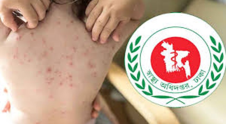হাম ও হামের উপসর্গ নিয়ে ৭ জনের মৃত্যু
