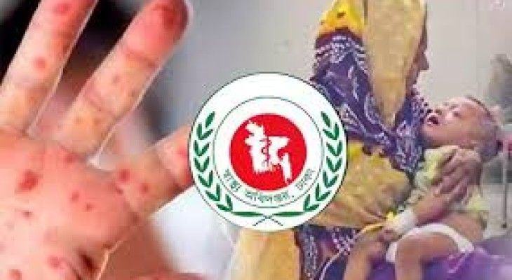 হাম ও হামের উপসর্গে আরও ১৭ শিশুর মৃত্যু